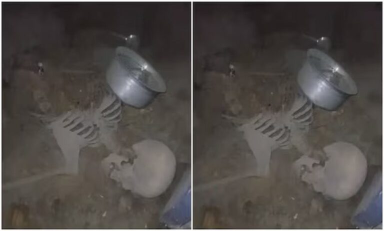 Human Skelton Nampally