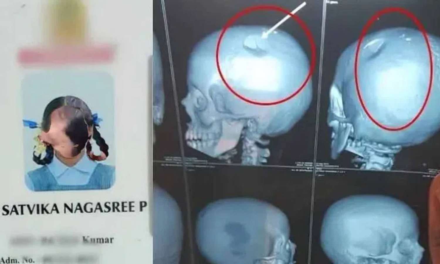 Chittoor School Incident