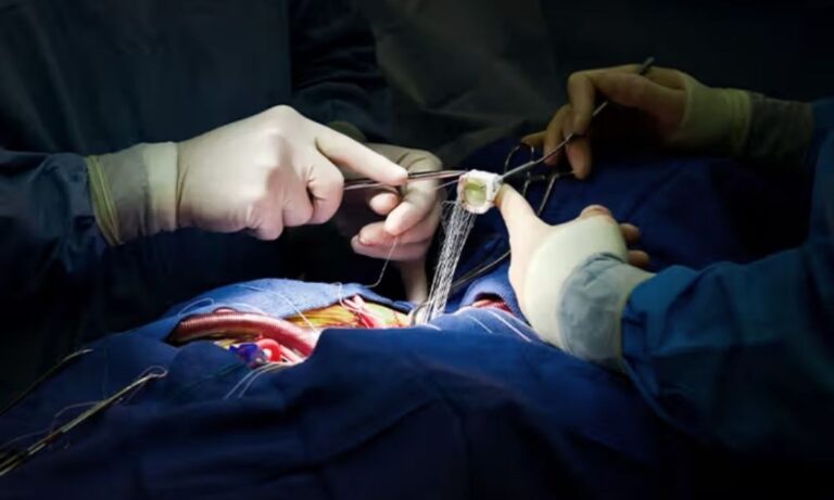 نمس میں بچوں کی کامیاب دل کی سرجری | Pediatric Heart Surgery